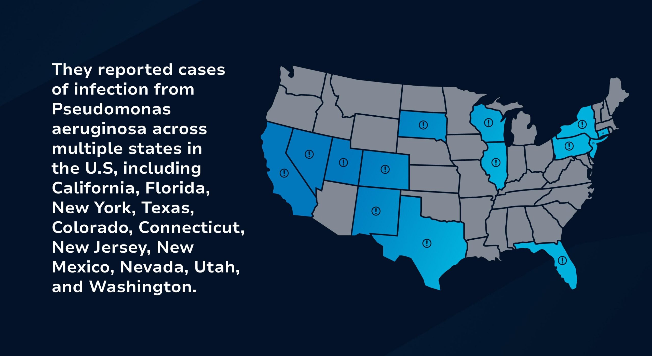 Ezricare Eye Drops Tort Experts